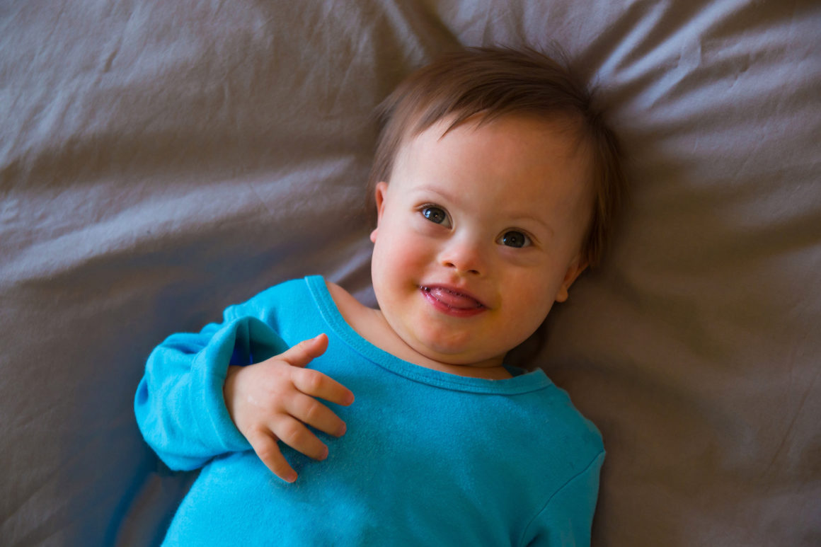 The Supreme Court Should Protect Unborn Children with Down Syndrome ...