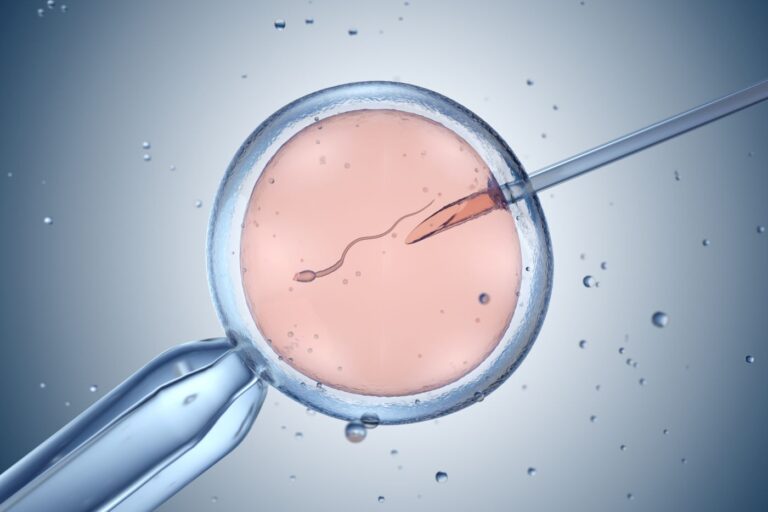 IVF