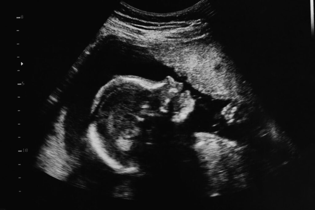 ultrasound image