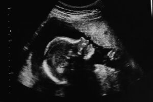 ultrasound image